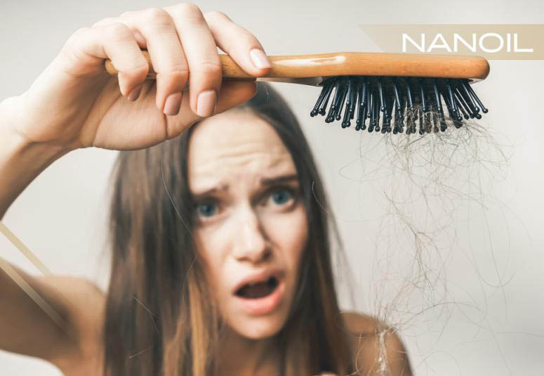 Wypadanie włosów – przyczyny. Jak zapobiec utracie włosów i zagęścić fryzurę?