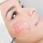 Cera naczynkowa - charakterystyka, pielęgnacja, kosmetyki